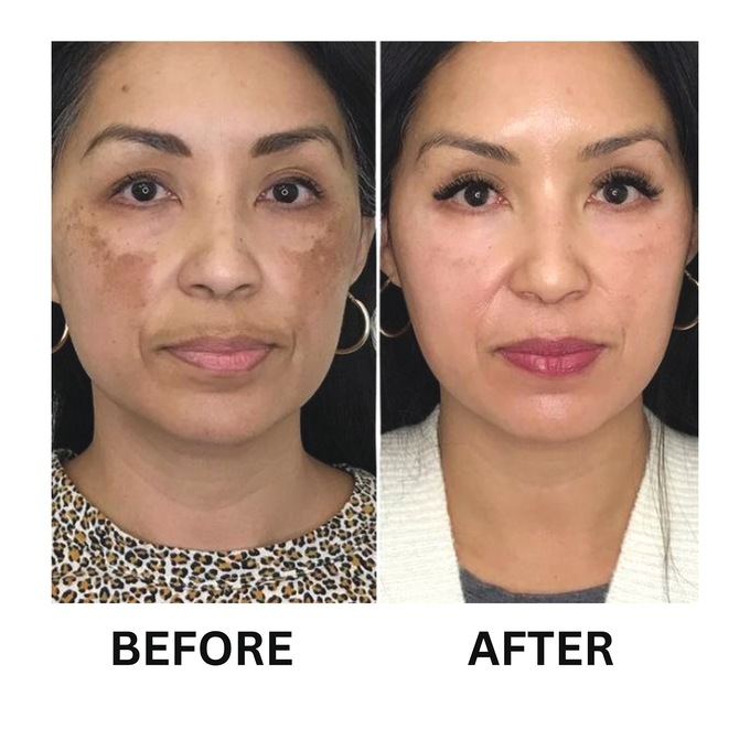 Skin Whitener Bleaching Cream, , large