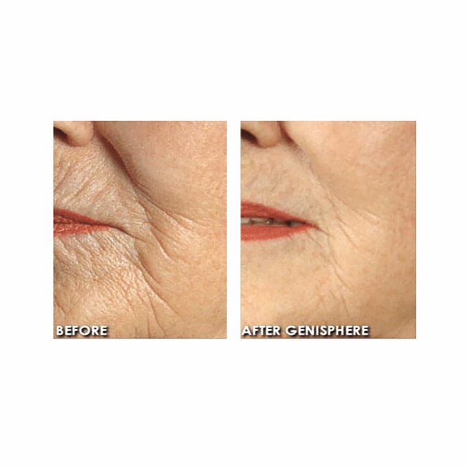 GeneSphere® with Acquacell, , large