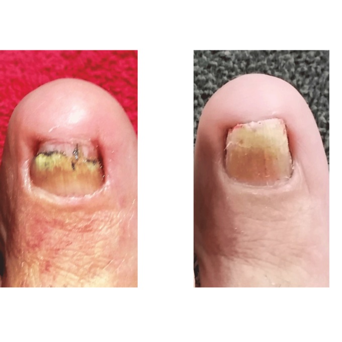 No Miss Fungus Killer&nbsp;, , large