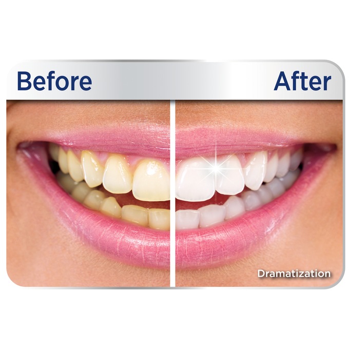 Miracle Smile Teeth Whitening Gel, , large