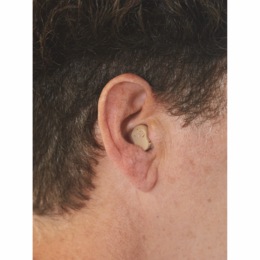 HEAR-ACLE Ear Sound Amplifier, , large