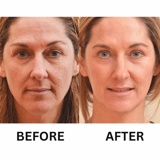 Retinol Wrinkle Miracle, , large