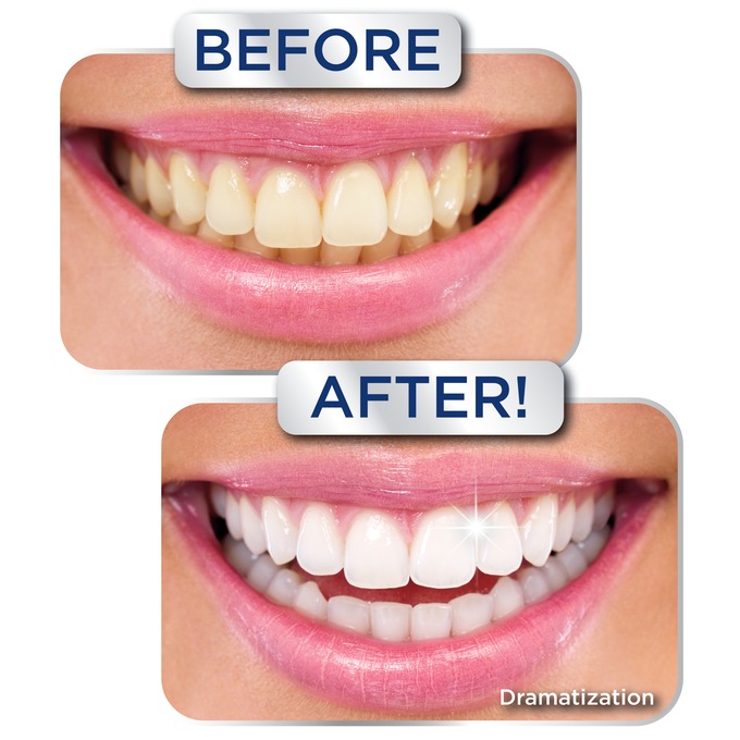 Miracle Smile Teeth Whitening Gel, , large