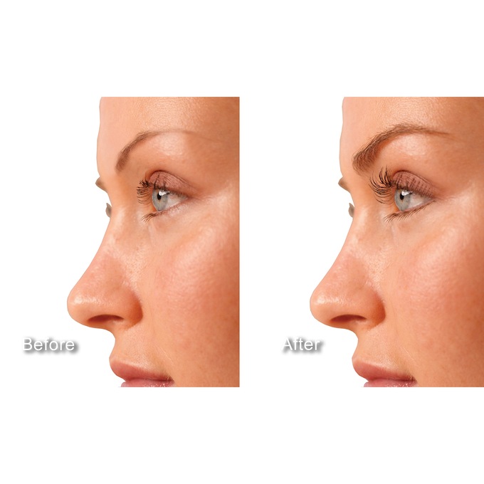 Double Lash & Brow Treatment, , large