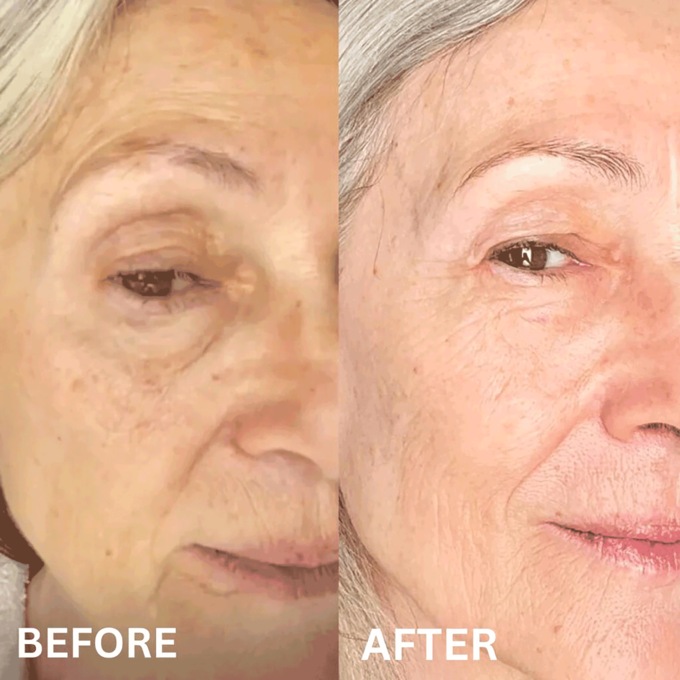 Skin Lightening Soap Facial Cleanser, , large