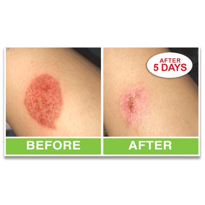 BodyVerde Miracle Skin Renew Serum, , large