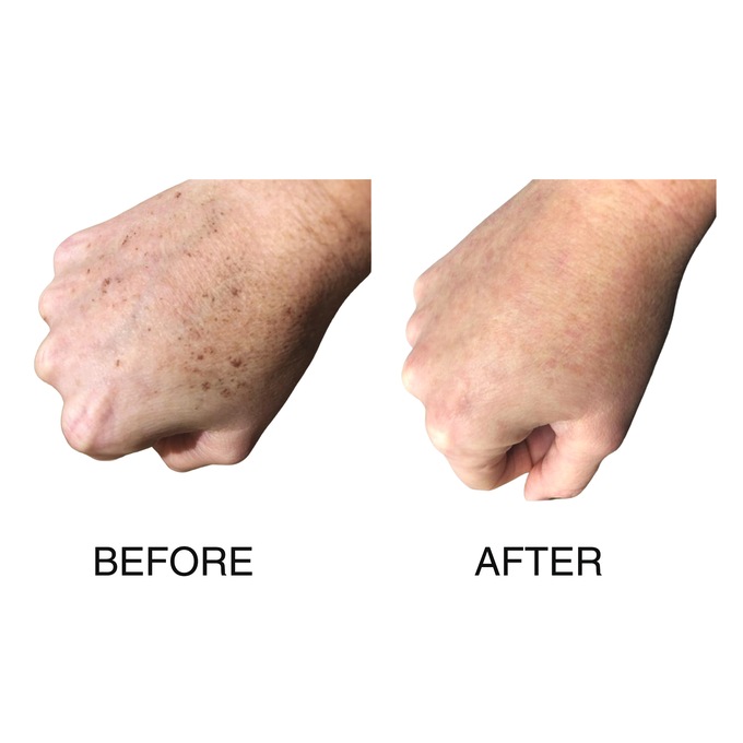 Skin Bleach Max Brightening Cream, , large