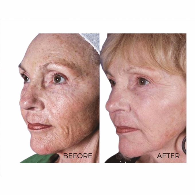 Age Spot Cream&nbsp;, , large