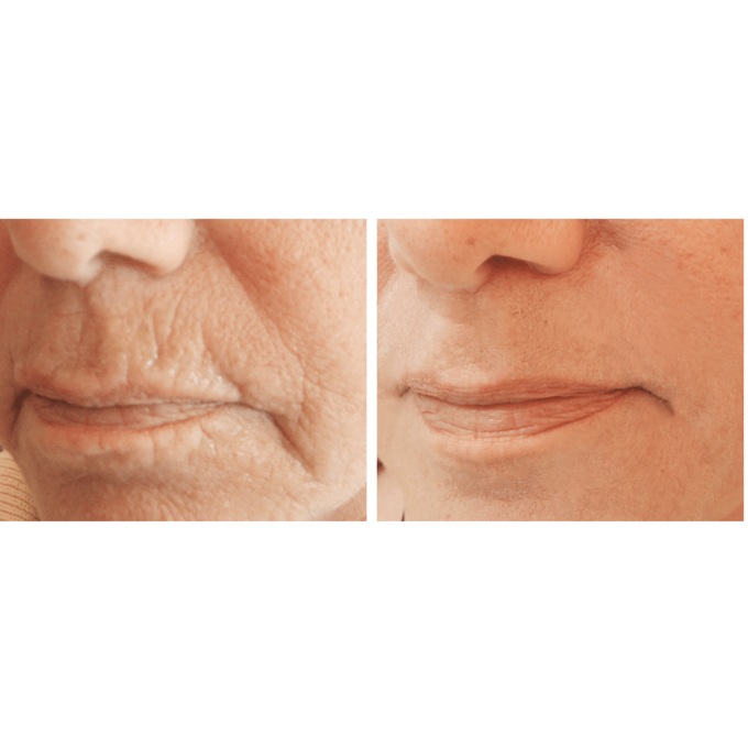 BodyVerde Wrinkle-Free Perfection Serum&nbsp;, , large